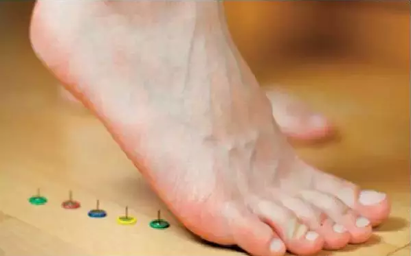 跑步脚痛？不只换鞋那么简单，小心足底筋膜炎